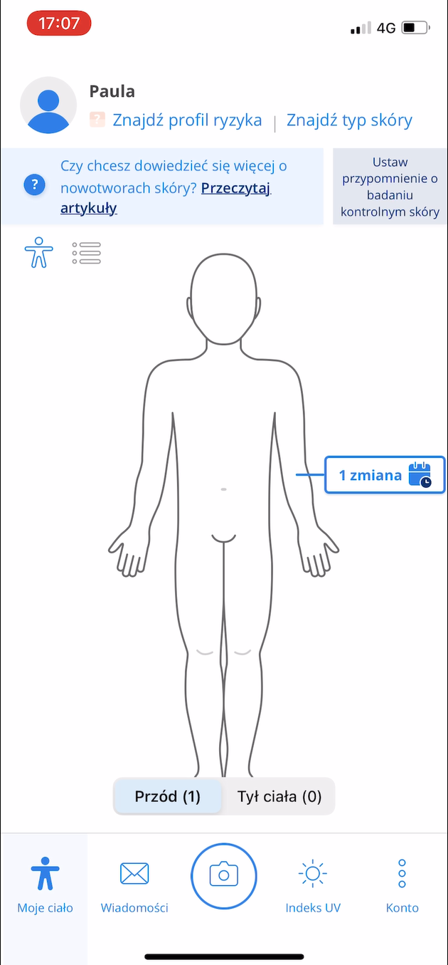 AI Skin Cancer Prevention - Skin cancer screening using AI and mobile ...